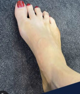 Erin Molan Feet