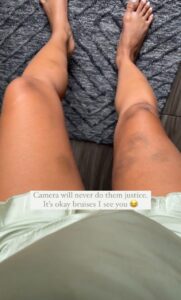 Jewelianna Ramos Ortiz Feet